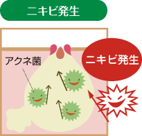 ニキビ発生