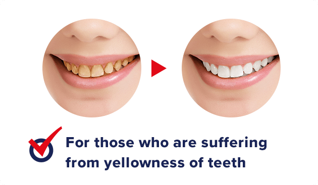 For those suffering from yellowing of teeth