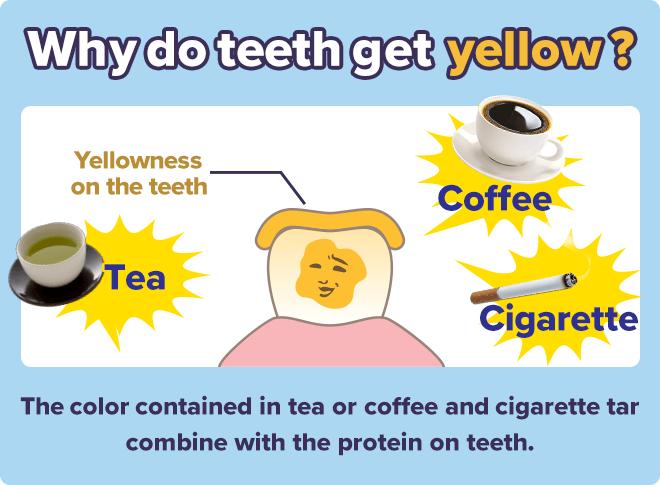 Why do teeth get yellow?　The color contained in tea or coffee and cigarette tar 
combine with the protein on teeth.