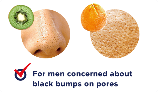 For boys concerned about black bumps on pores
