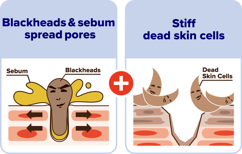Blackheads & sebum spread pores　Stiff dead skin cells
