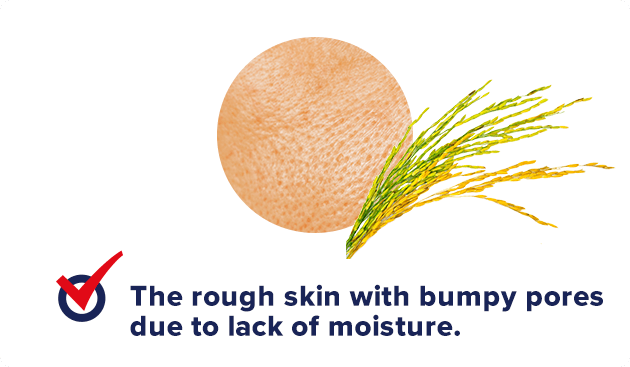 The rough skin with bumpy pores due to lack of moisture.