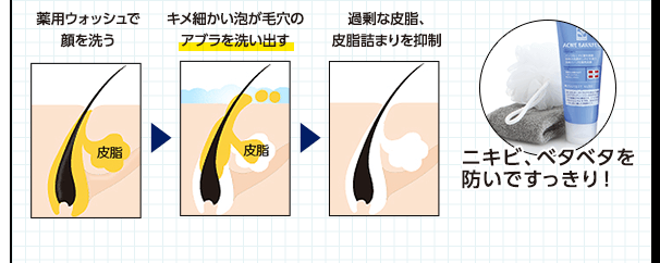 薬用ウオッシュで顔を洗う キメの細かい泡が毛穴のアブラを洗い出す 過剰な皮脂、皮脂詰まりを抑制 ニキビ、ベタベタを防いですっきり!