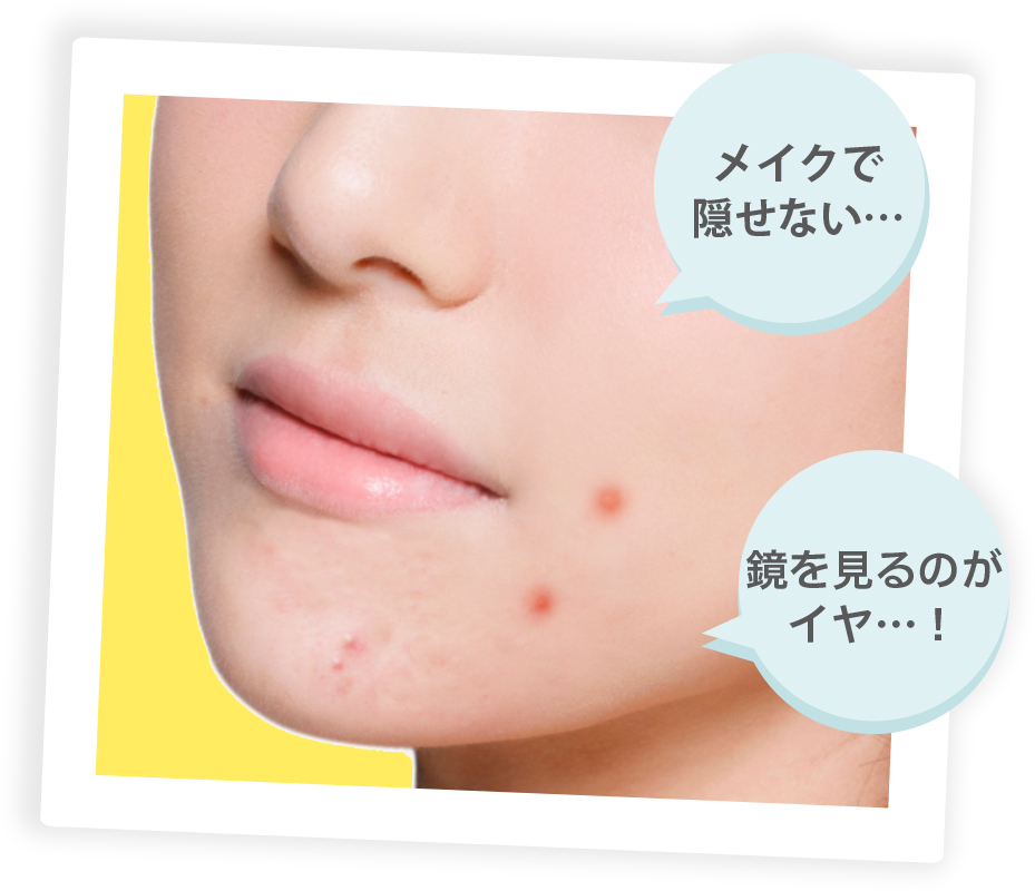 メイクで隠せない・・・ 鏡を見るのがイヤ・・・!