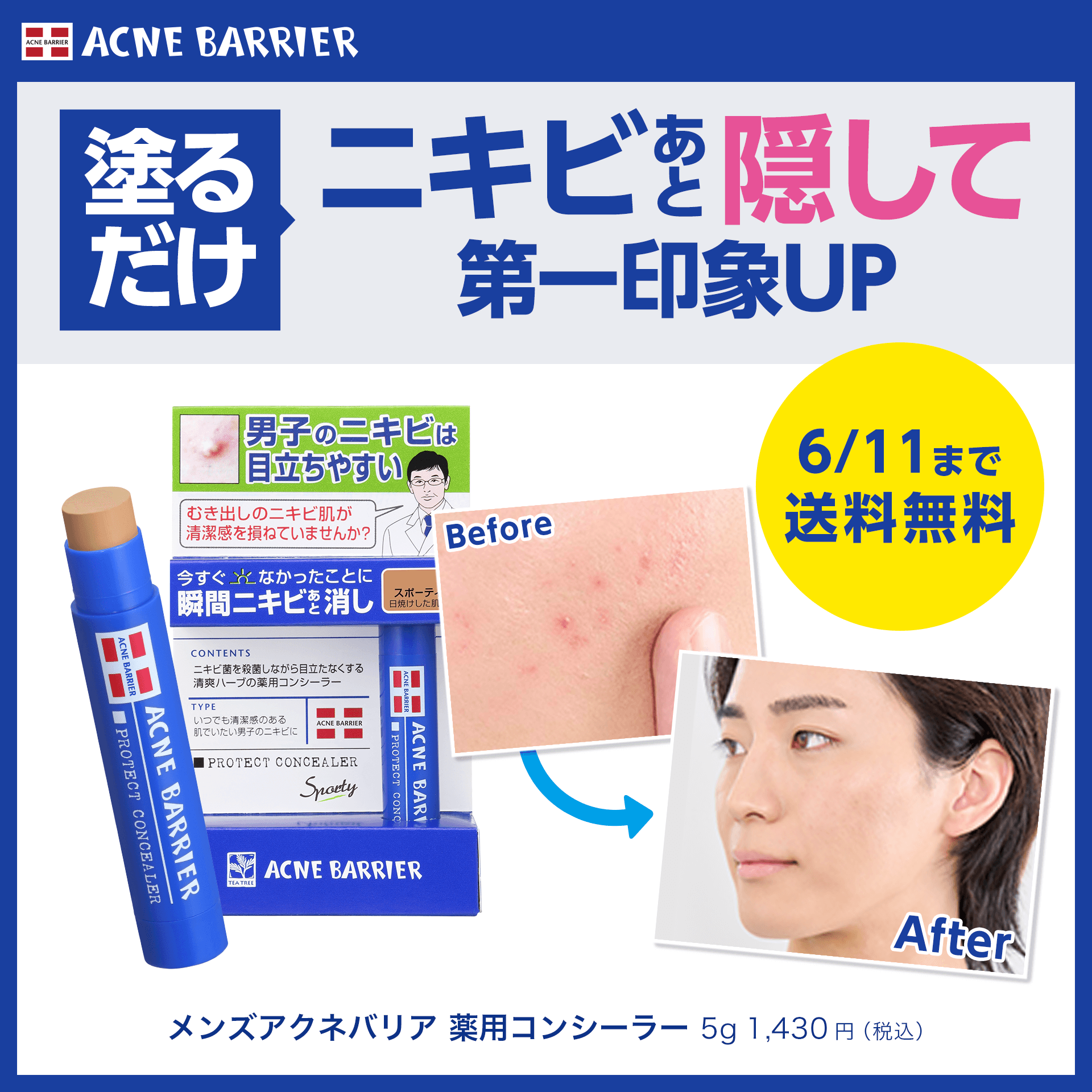 薬用コンシーラー　送料無料キャンペーン