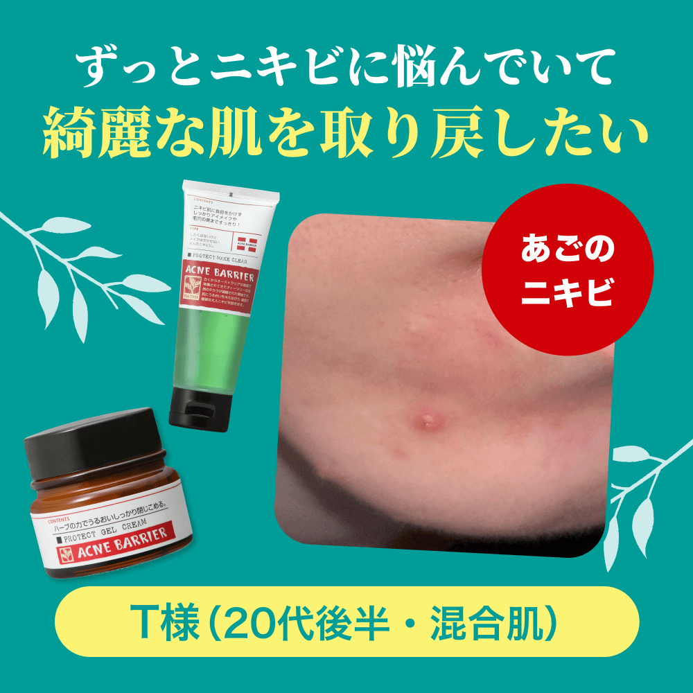 T様レポートページ