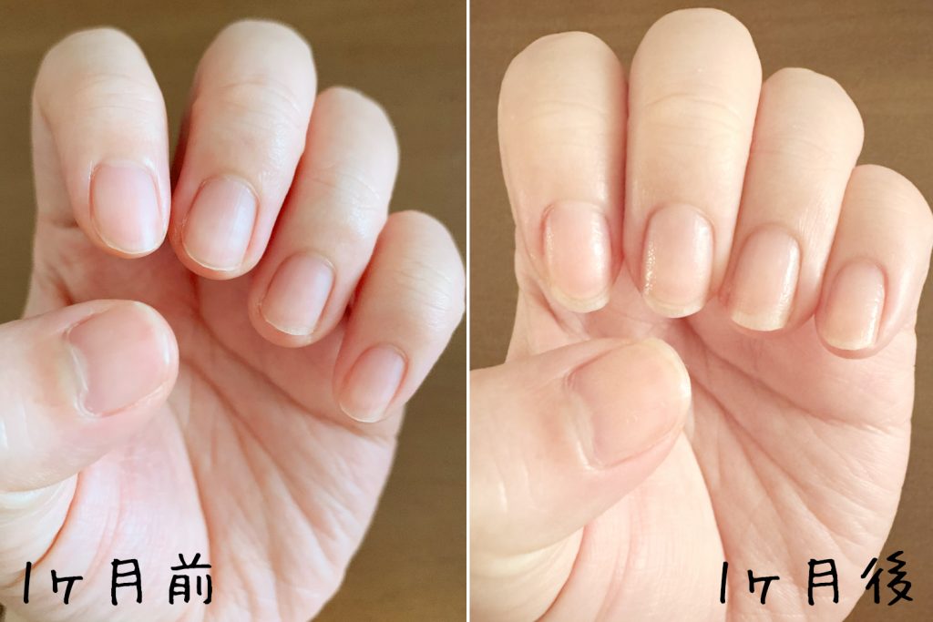 1ヶ月→4ヶ月検証】ハイポニキウムの保湿ケアを続けてみた！保湿オイル