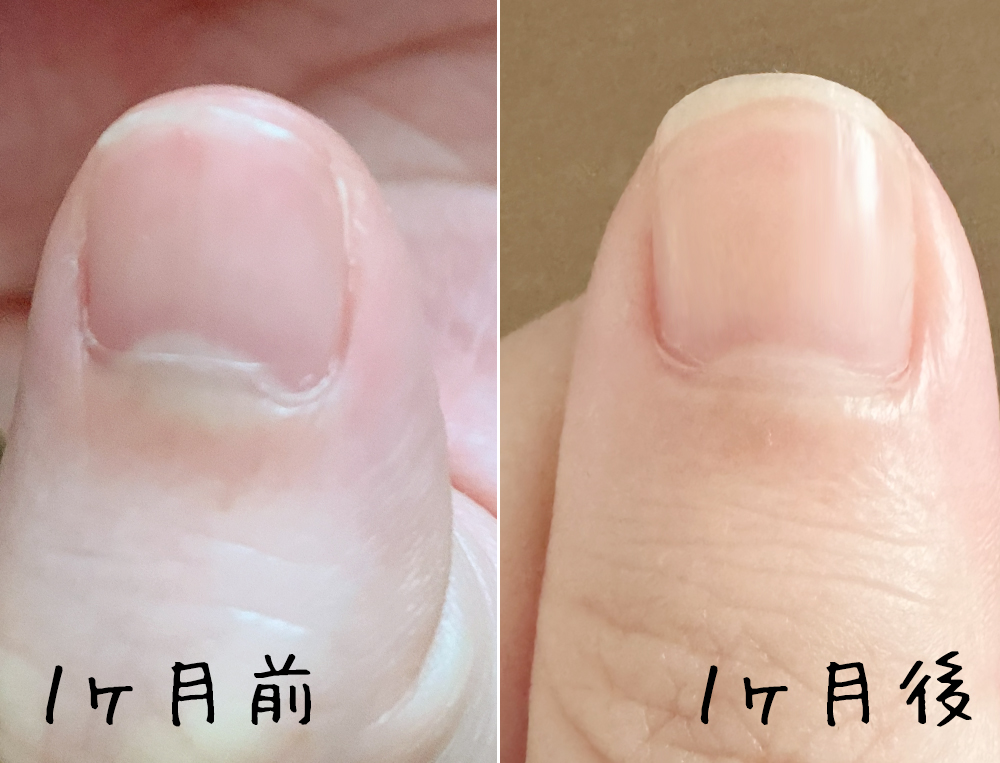 1ヶ月→4ヶ月検証】ハイポニキウムの保湿ケアを続けてみた！保湿オイル