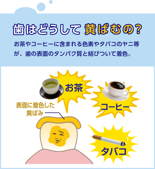 歯はどうして黄ばむの? お茶やコーヒーに含まれる色素やタバコのヤニ等が、歯の表面のタンパク質と結びついて着色。 表面に着色した黄ばみ お茶 コーヒー タバコ