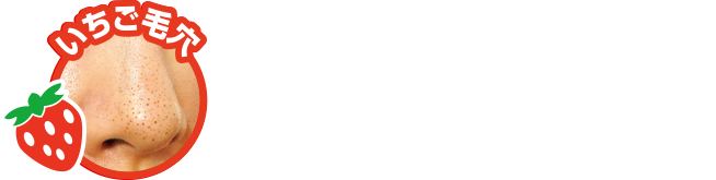 いちご毛穴 ブツブツ目立つ角栓が原因