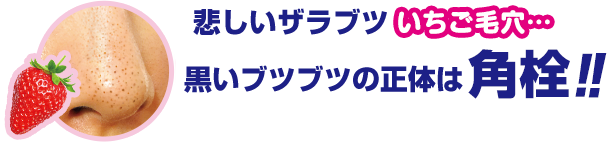 悲しいザラブツいちご毛穴…　黒いブツブツの正体は角栓！！