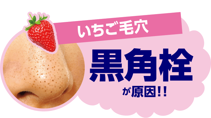 いちご毛穴 黒角栓が原因！！