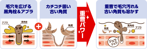 毛穴を広げる黒角栓＆アブラ　カチコチ固い古い角質　重曹で毛穴汚れ＆古い角質も溶かす