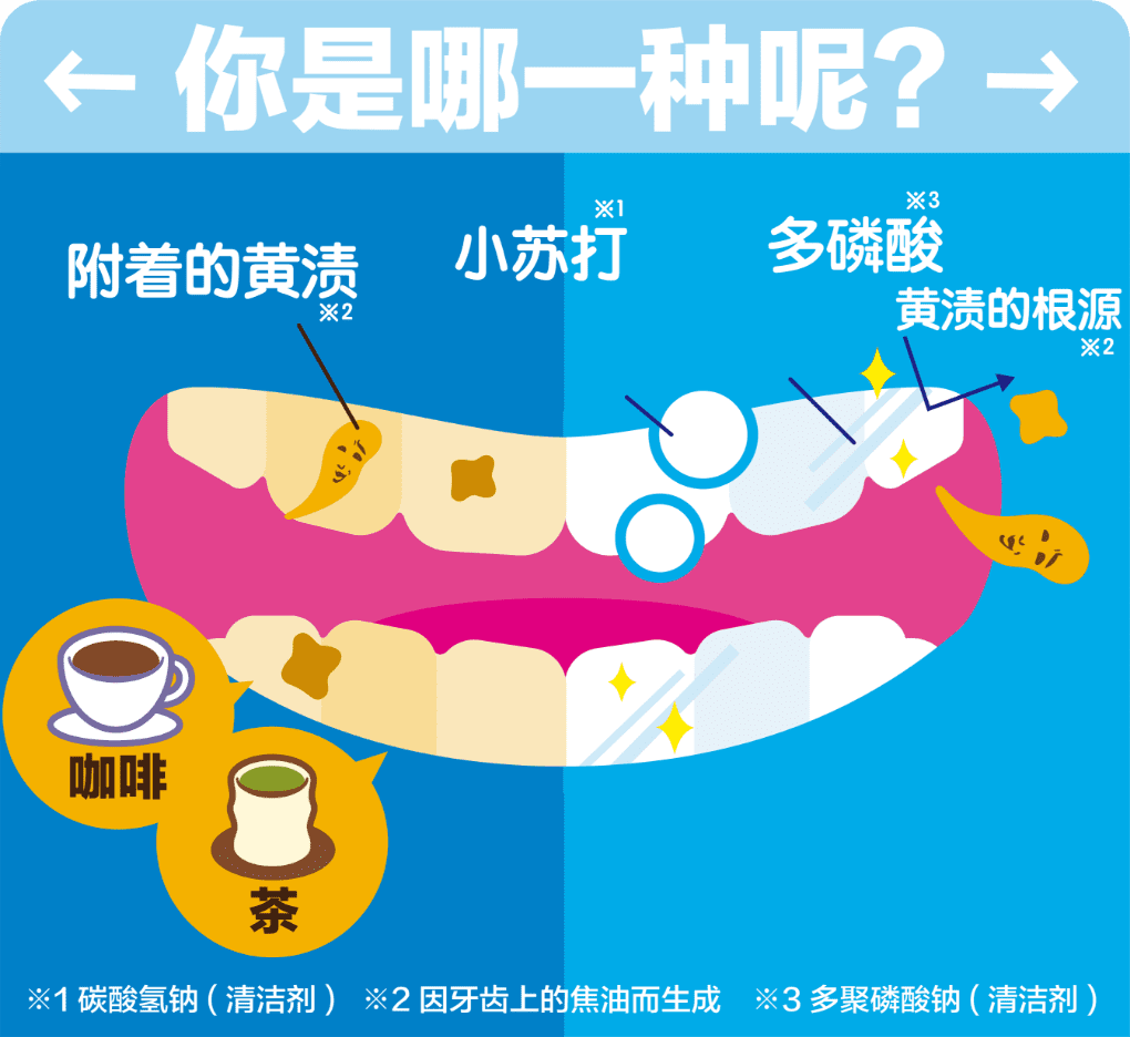 你是哪一种呢？