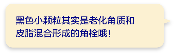 黑色小颗粒其实是老化角质和皮脂混合形成的角栓哦！