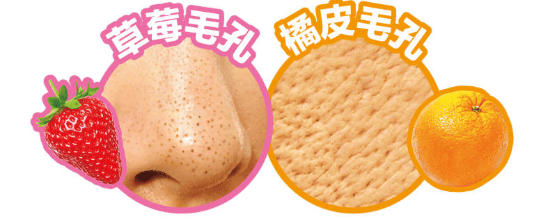 草莓毛孔 橘皮毛孔