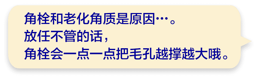 角栓和老化角质是原因…。放任不管的话，角栓会一点一点把毛孔越撑越大哦。