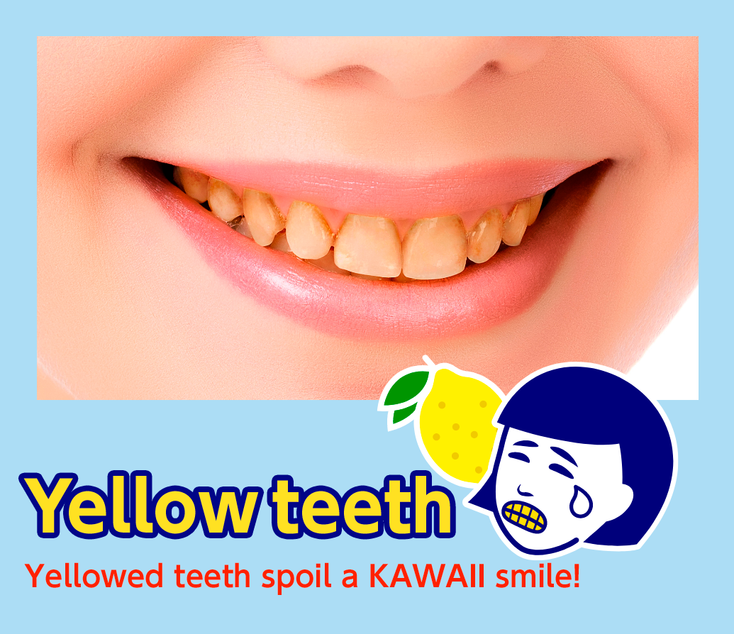 Yellow teeth
        Yellowed teeth spoil a KAWAII smile!