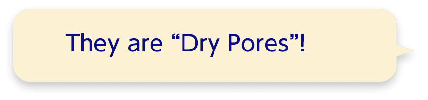 They are “Dry Pores”!
