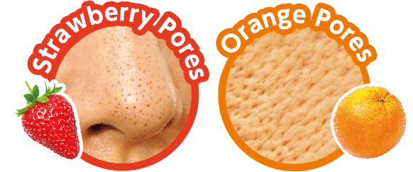 Strawberry Pores & Orange Pores