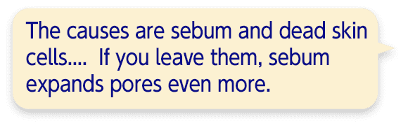 The causes are sebum and dead skin cells.... If you leave them, sebum expands pores even more.