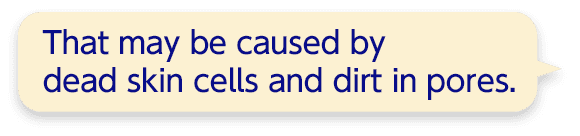 That may be caused by dead skin cells and dirt in pores.