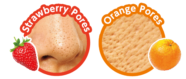 Strawberry Pores & Orange Pores