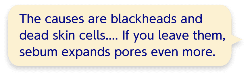 The causes are blackheads and dead skin cells.... If you leave them, sebum expands pores even more.