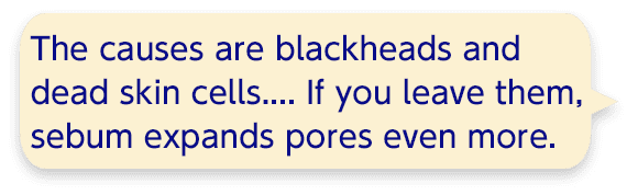 The causes are blackheads and dead skin cells.... If you leave them, sebum expands pores even more.