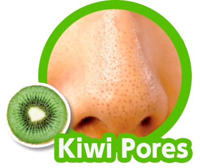 Kiwi Pores