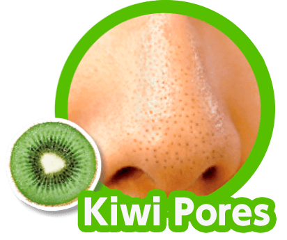 Kiwi Pores