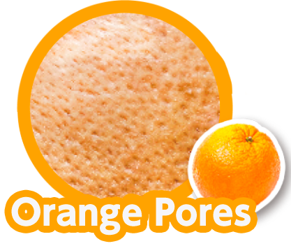 Orange Pores