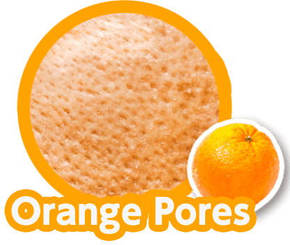 Orange Pores