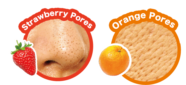 Orange Pores & Strawberry Pores