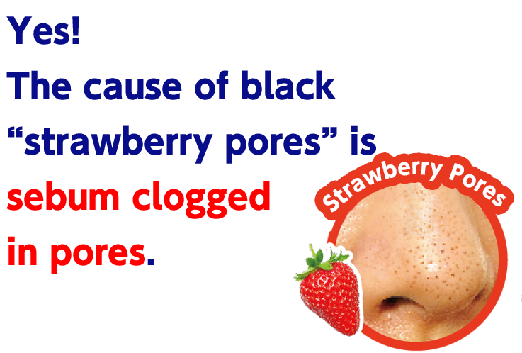 Yes! The cause of black “strawberry pores” is sebum clogged in pores.