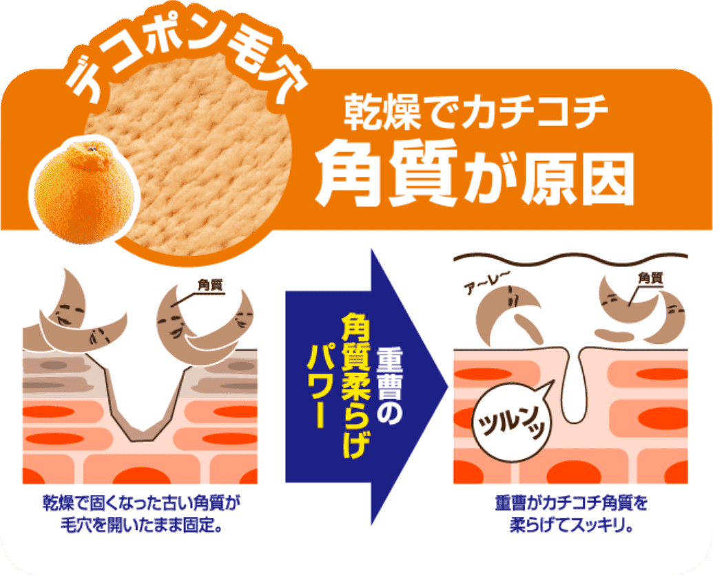 デコポン毛穴 乾燥でカチコチ角質が原因