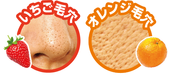 いちご毛穴とオレンジ毛穴