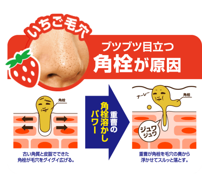 いちご毛穴 ブツブツ目立つ角栓が原因