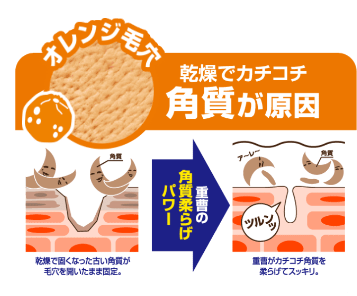 オレンジ毛穴 乾燥でカチコチ角質が原因