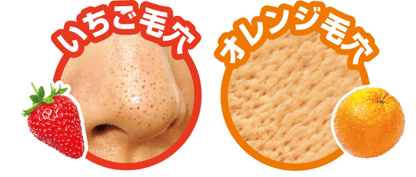 いちご毛穴とオレンジ毛穴