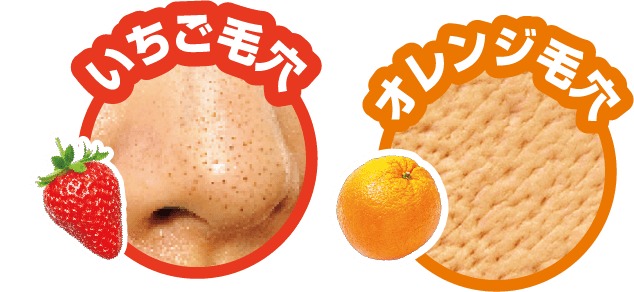 いちご毛穴とオレンジ毛穴