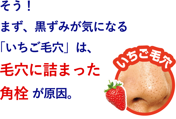 そう！まず、黒ずみが気になる「いちご毛穴」は、毛穴に詰まった角栓が原因。