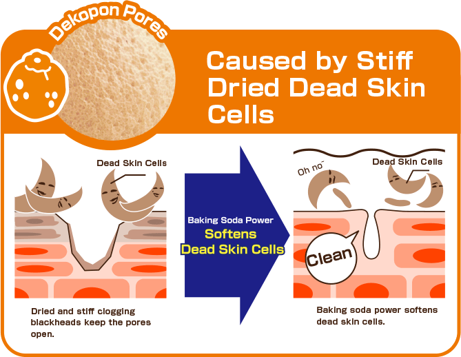デコポン毛穴　乾燥でカチコチ角質が原因