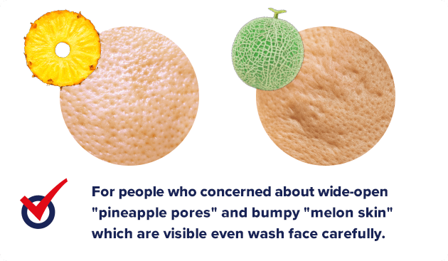 For people who concerned about wide-open pineapple pores and bumpy melon skin which are visible even wash face carefully.