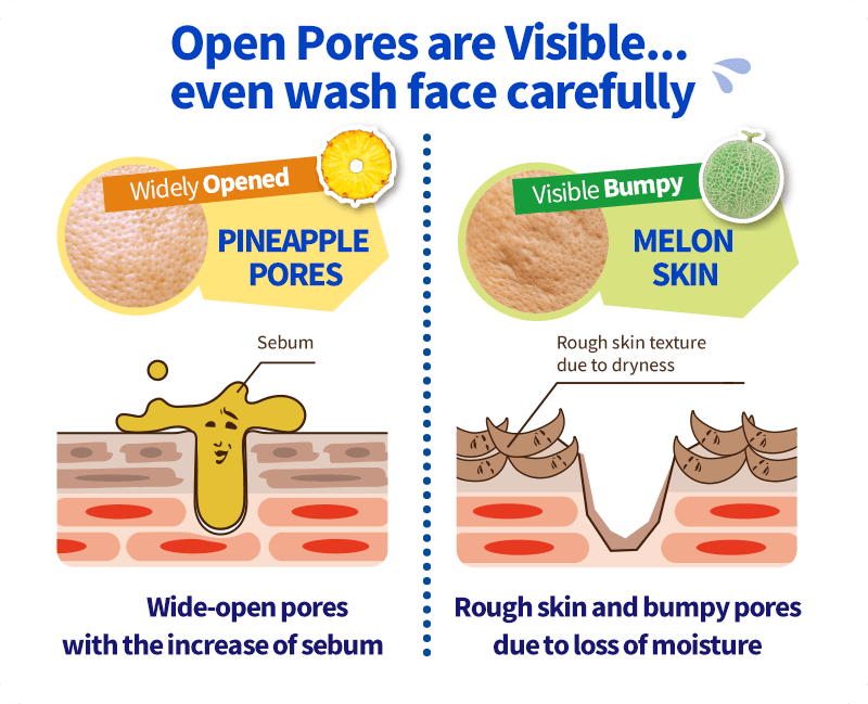 Open Pores are Visible... even wash face carefully