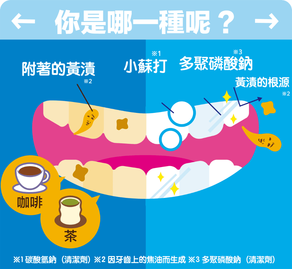 你是哪一種呢?