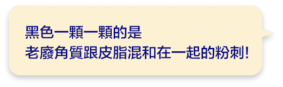 黑色一顆一顆的是
        老廢角質跟皮脂混和在一起的粉刺!