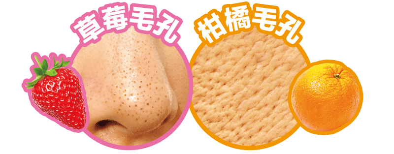 草莓毛孔 柑橘毛孔
