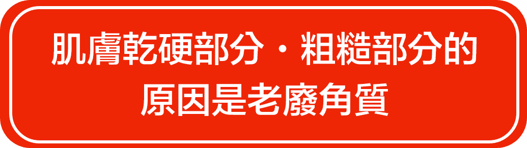 肌膚乾硬部分・粗糙部分的原因是老廢角質