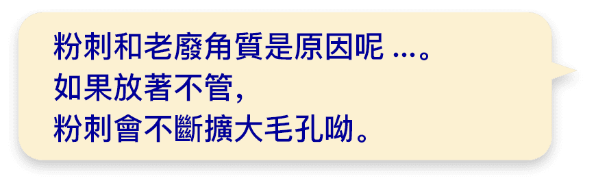 粉刺和老廢角質是原因呢...。如果放著不管，粉刺會不斷擴大毛孔呦。